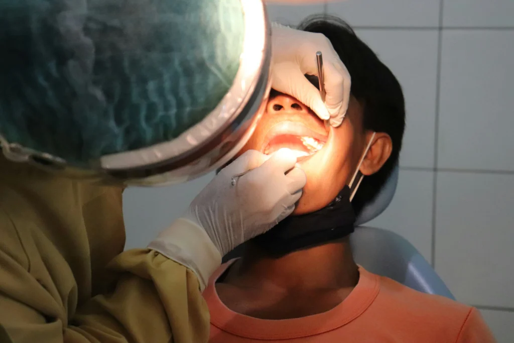 Ontstoken tandvlees - Gingivitis